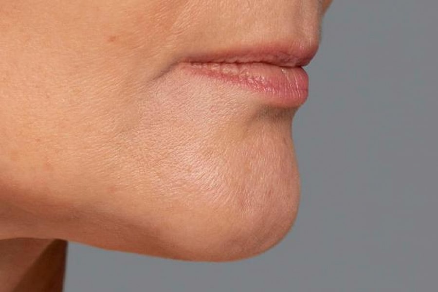 Фото работы Антиэйдж процедуры для лица 1 Мини