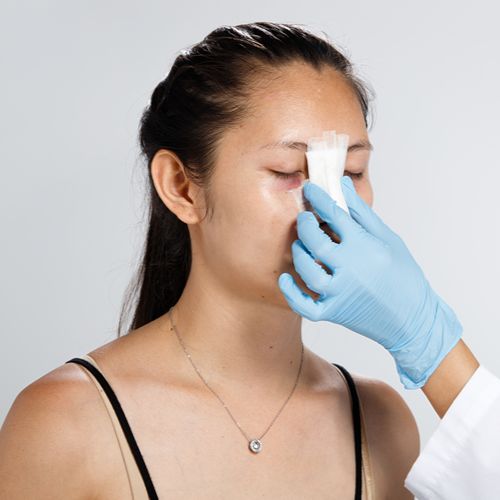 Постхирургическая