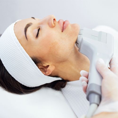 RF-лифтинг лица