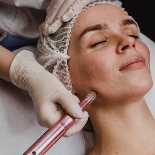 Микроигольчатый Rf-лифтинг