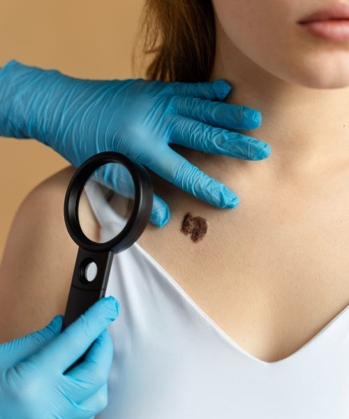Получите бесплатную дерматоскопию на приёме!