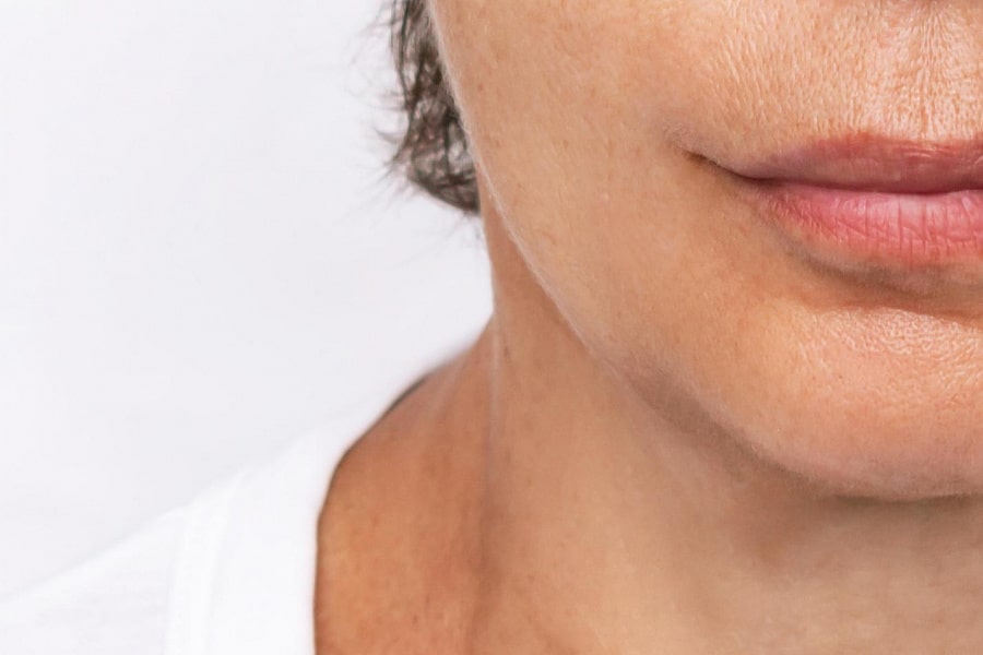 Фото работы RF омоложение лица и шеи на аппарате Indiba 1 Мини