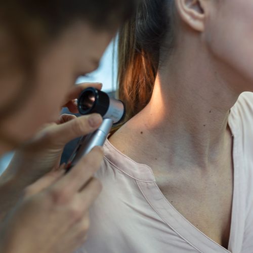 Удаление родинок