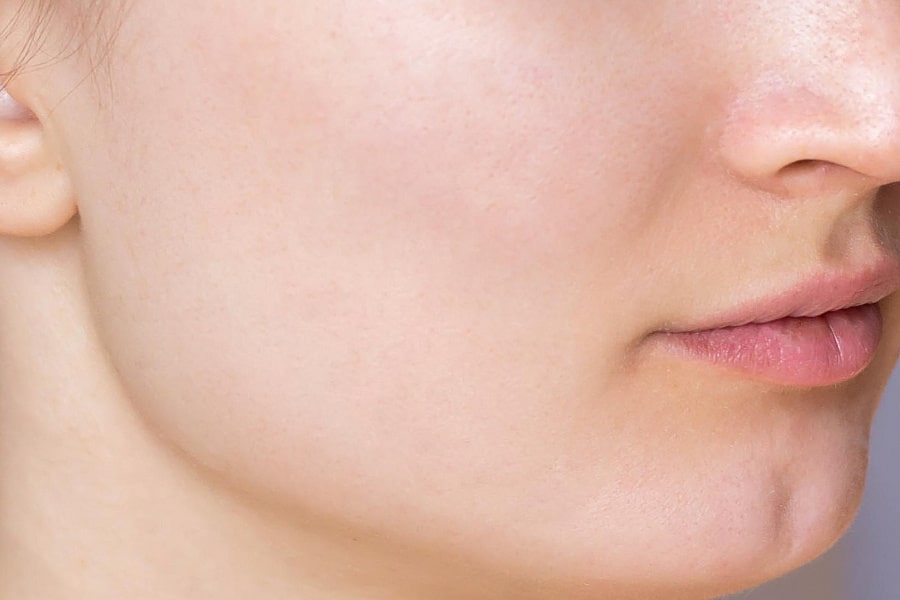 Фото работы Лечение акне на аппарате Indiba 1 Мини