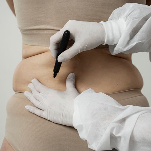 Коррекция фигуры