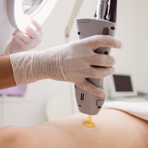 Удаление рубцов и шрамов