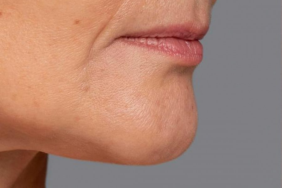 Фото работы Антиэйдж процедуры для лица 2 Мини